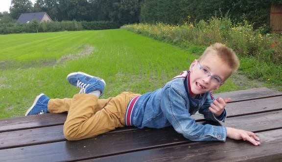 Ouders over cochleaire implantatie van dove kinderen met bijkomende beperkingen