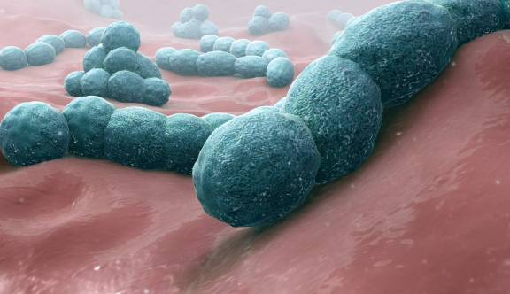 Gehoorverlies na meningitis