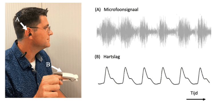 Figuur 1. Meetopstelling voor de geluidsmetingen. De opnamemicrofoon wordt in het uitwendige oorkanaal geplaatst (pijl A) en via een sensor op de vingertop wordt de hartslag gemeten (pijl B)